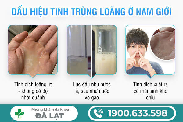 Hình ảnh minh họa